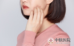 讲解女性牛皮癣患者注意事项 牛皮癣患者饮食禁忌