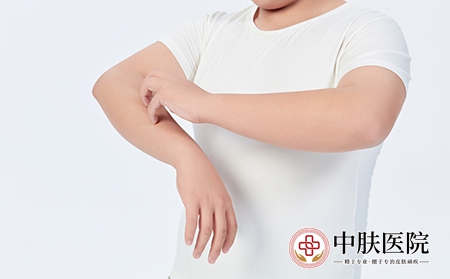 摄图网_501687661_青少年儿童皮肤瘙痒（企业商用）