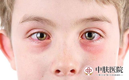 2 (273)眼睛