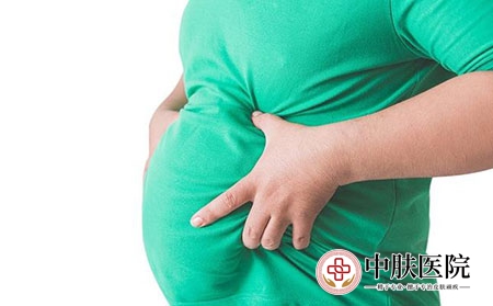 2 (51)肥胖