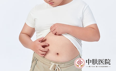摄图网_501687663_青少年儿童皮肤瘙痒（企业商用）