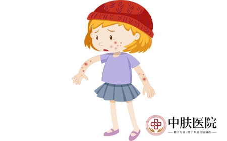 摄图网_401477102_长湿疹的女孩（企业商用）