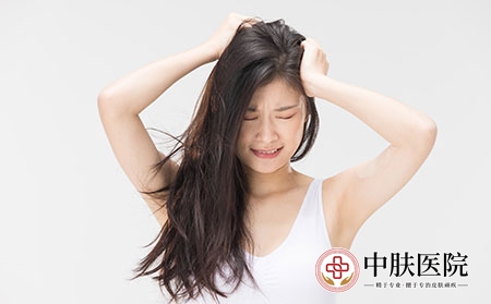 摄图网_501713659_脱发问题抓头苦恼的年轻女性（企业商用）