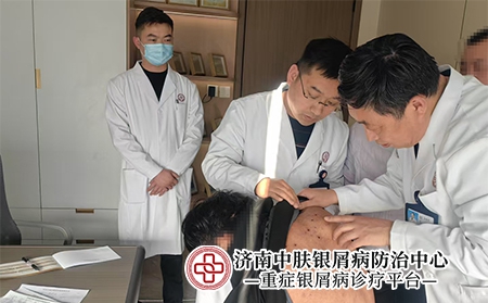 济南银屑病排名-济南中肤银屑病医院 济南银屑病排名-济南中肤银屑病医院