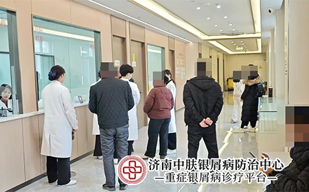 济南银屑病医保-济南中肤银屑病医院