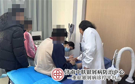 济南银屑病医院排名-济南中肤银屑病医院