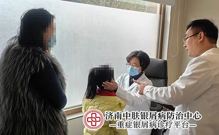 济南哪个银屑病医院专业-济南中肤银屑病医院