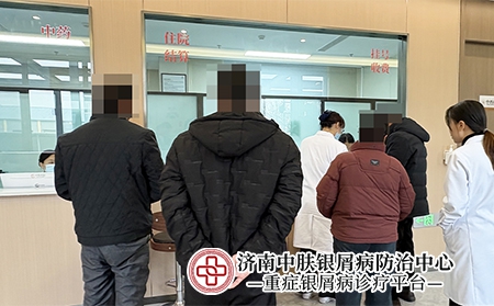 济南银屑病研究所怎样联系-济南中肤银屑病医院